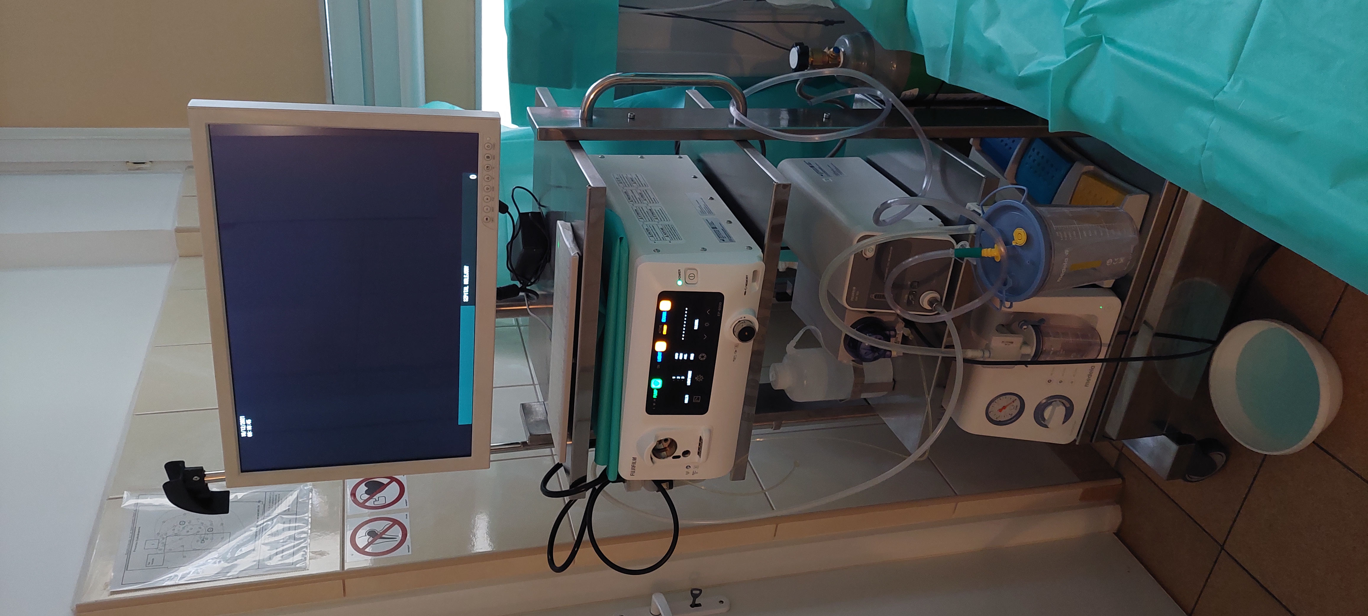 Sprzęt endoskopowy Zakup sprzętu i aparatury medycznej dla Szpitala Kolejowego w Pruszkowie