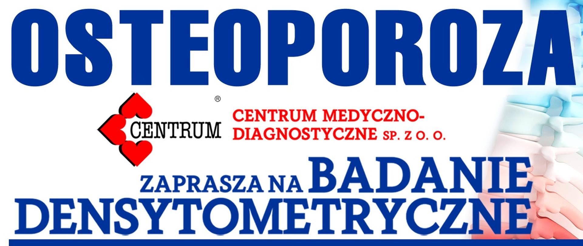 Osteoporoza