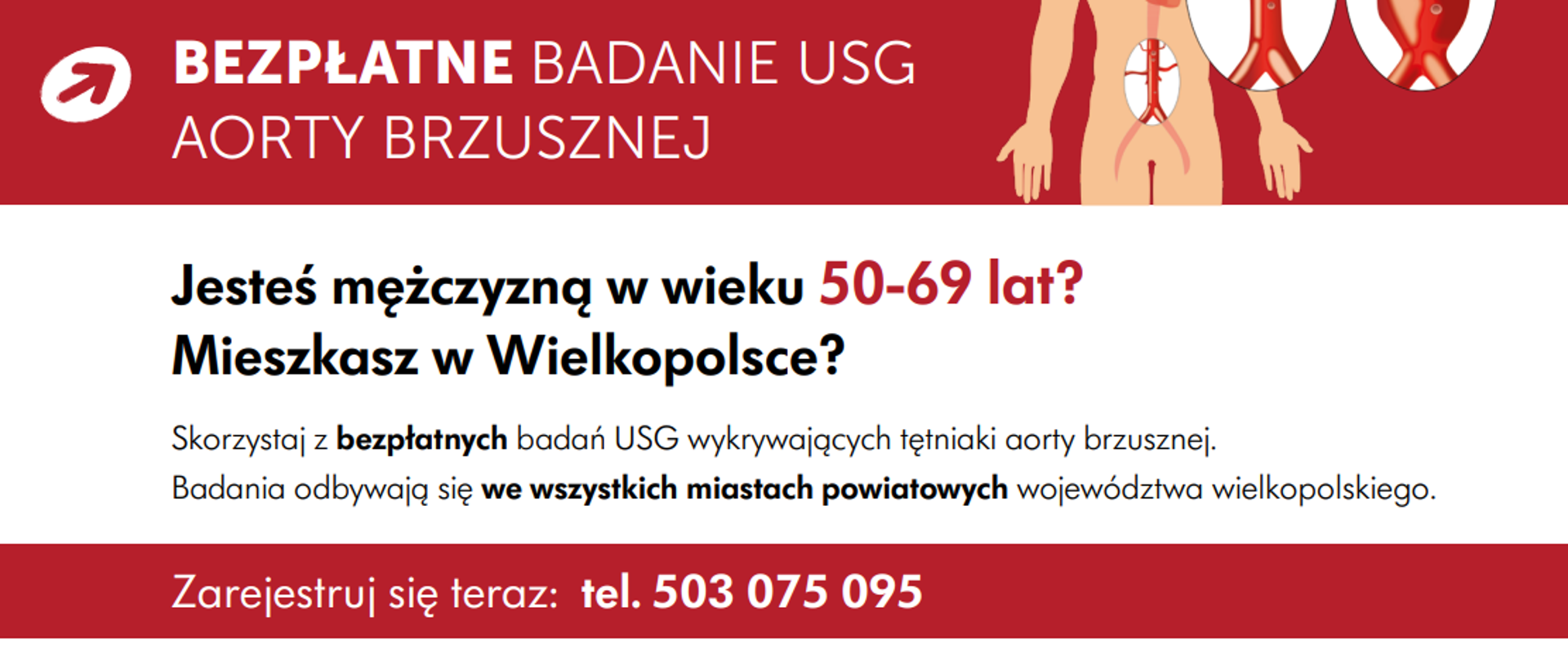 Baner Zdrowa Aorta