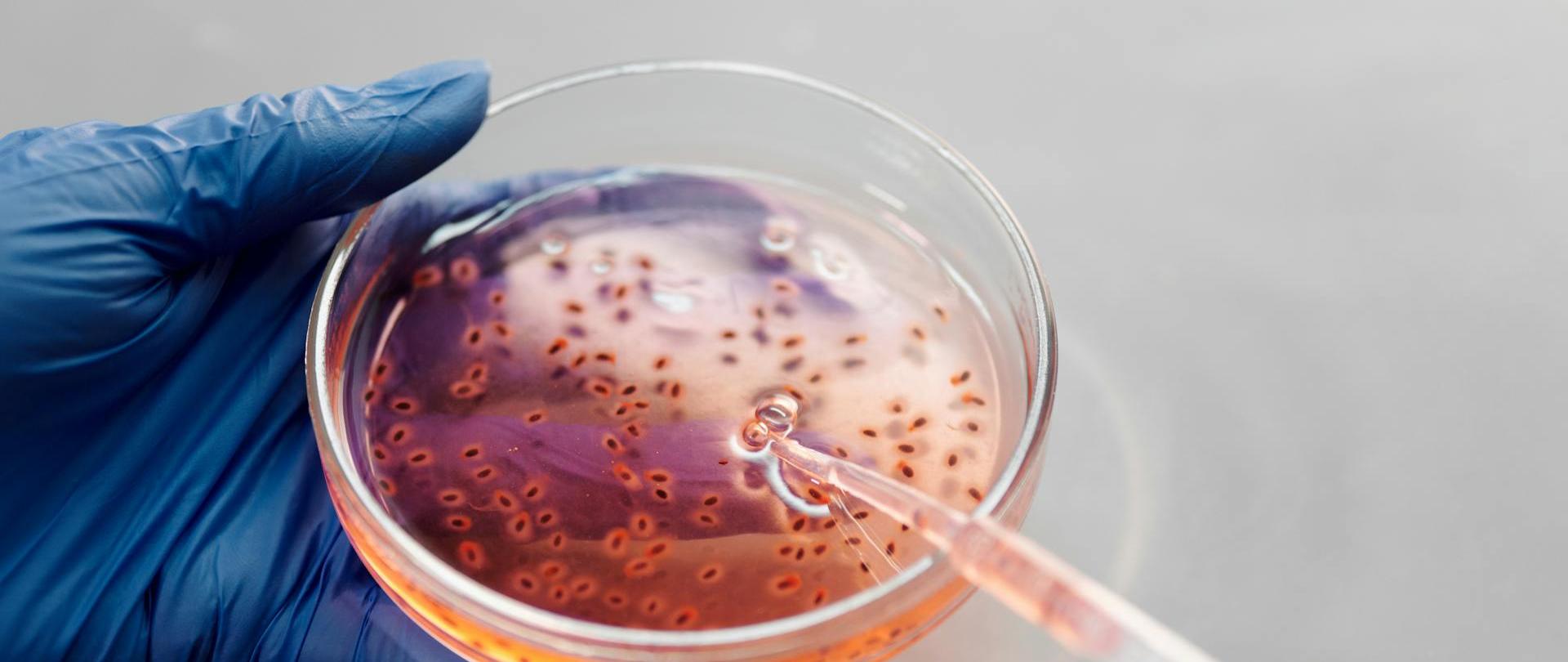 Człowiek trzyma w ręce szkiełko laboratoryjne z bakteriami. W drugiej ręce trzyma pipetkę, którą pobiera płyn.